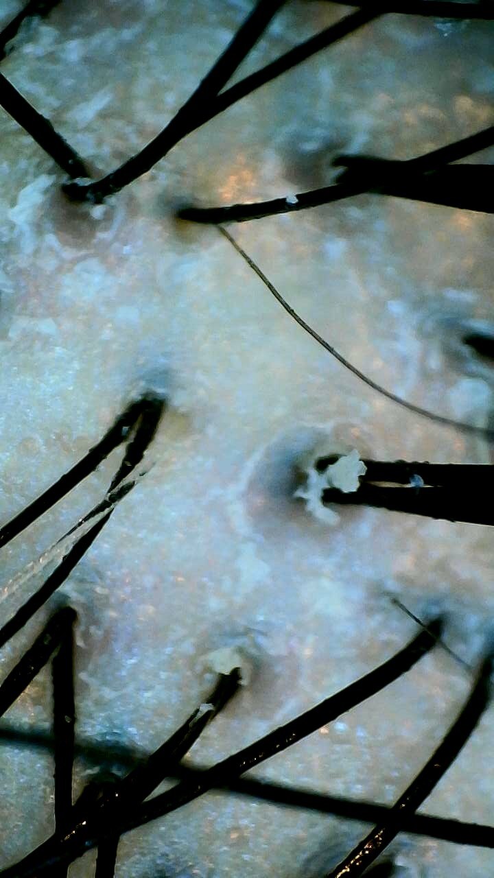 ※閲覧注意※　頭皮診断、なぜ必要なんでしょう？_20230201_2