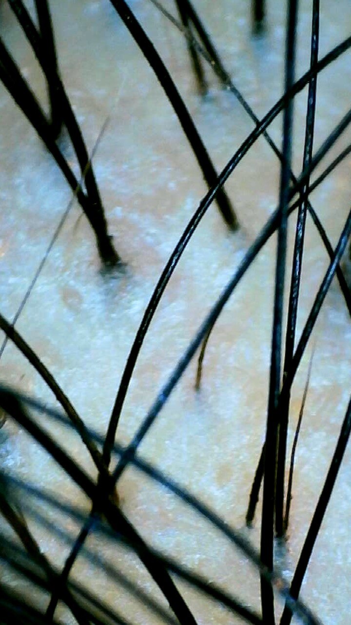 ※閲覧注意※　頭皮診断、なぜ必要なんでしょう？_20230201_3